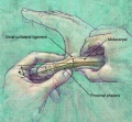 Entorse du pouce : diagnostic et opération - Dr Fontes Chirurgien ...