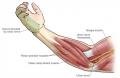 Syndrome de compression du nerf cubital - Dr Fontes Chirurgien de ...