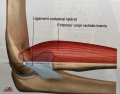 Les tendinites du poignet, Centre de Chirugie du Membre Supérieur Trénel